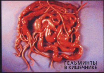 гельминты в кишечнике